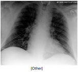 x-ray example